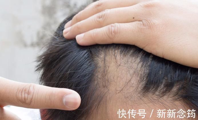 尿频尿急|男性开始变老的6大迹象,若一个不占,说明身体还很健康