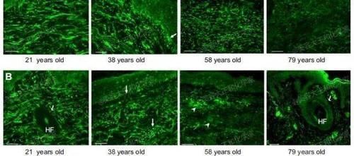 皮肤|你的日常=最强衰老预警难怪你没有姐姐们的逆天状态