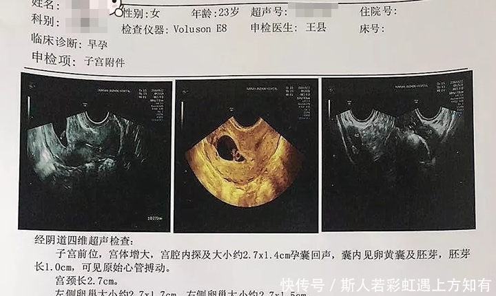 孕妇|确定怀孕后,第一次产检是在什么时候?超过这个时间,就晚了