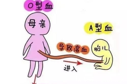 怀胎|这两种血型的妈妈,首次怀胎最好别流,第一个宝宝对你很重要
