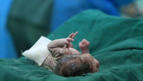 小动作|我就是不哭!”剖腹产宝宝“眼神杀”太霸气,网友:是个狠人