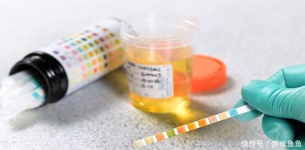 降低|尿酸“克星”已被发现,没事吃一点,降低尿酸,痛风离你而去!