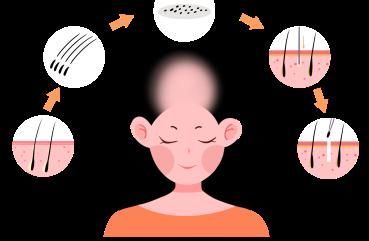 生长期|脱发和正常掉发有本质区别！