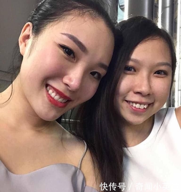 cpr|为结婚准备瘦身,23岁模特抽脂死在手术台,无照医生手术时表现慌张