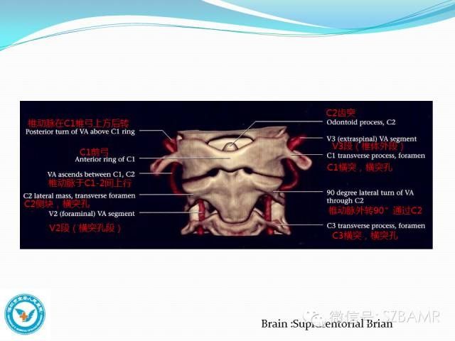 mr|椎-基底动脉系统解剖