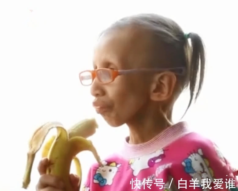 女孩|14岁女孩像80岁老人,做完手术的1句话,让医生父母纷纷落泪