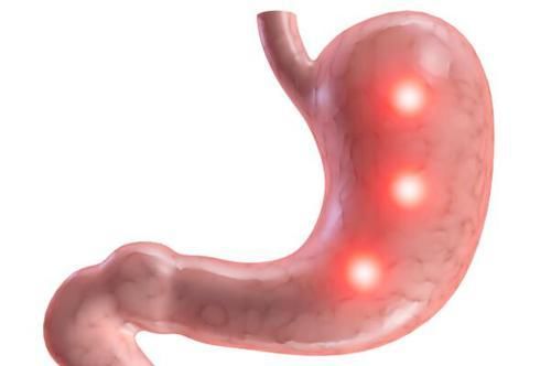  不好|胃不好的人，这5类食物尽量避开，不利于胃病患者的健康！