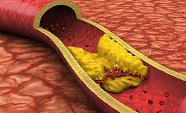 脚底|脖子一动就“咔咔”响,是颈椎病“作祟”真相和解决方法都在这