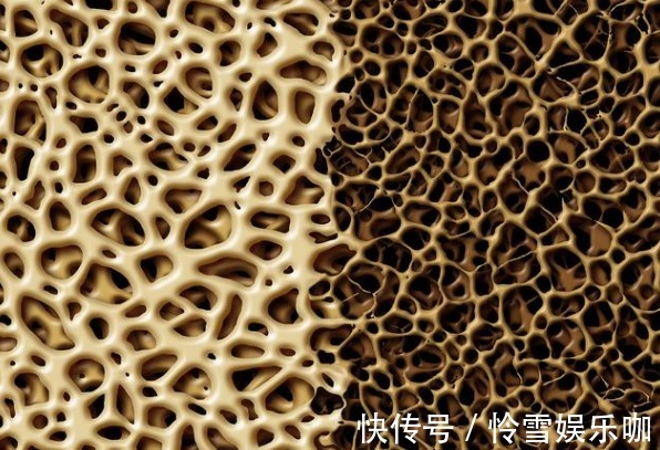 运动锻炼|更年期综合征,运动锻炼有用吗?医生全面总结4方面获益