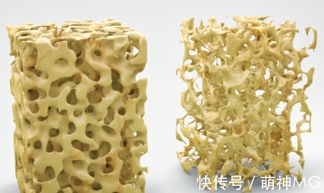 食物|医生建议:女人别太节省,常吃4种食物,或有助补充雌激素