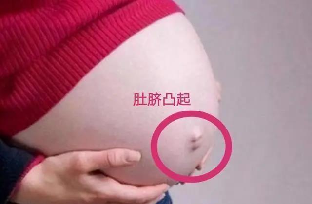 妈妈们|为何孕妈肚脐有的凸起来,有的凹进去?和生男生女有关吗?