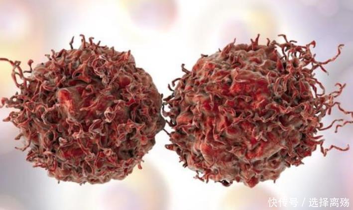 癌症早期|为什么癌症早期都不痛不痒、毫无症状看完受益终身