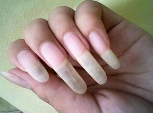 毛细血管|人闲下来是不是容易长指甲,心宽的人是不是容易长头发?