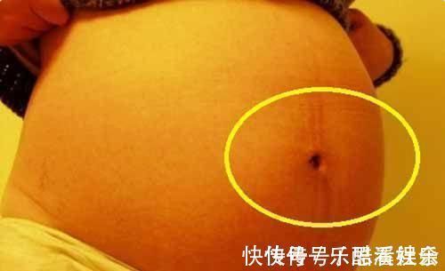 准妈妈|孕妈肚脐凸比凹好?别自己吓自己,区别倒是有,真相孕妈要了解