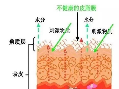 皮肤过敏|各种类型肌肤缺水的自我诊断及应对方法，你知道多少？