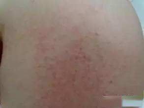 急诊科三天连收近10例，极度凶险！春节千万要警惕！