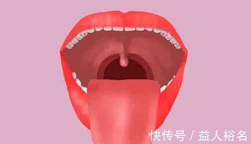 扁桃体|孩子嘴里气味难闻,检查发现长了结石!告诉你,它是怎么来的