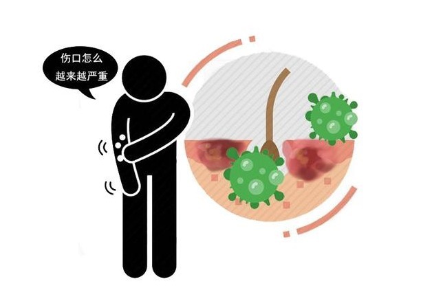 疾病|体内有病，嘴巴告知？嘴唇出现5种迹象，或疾病信号，希望别大意