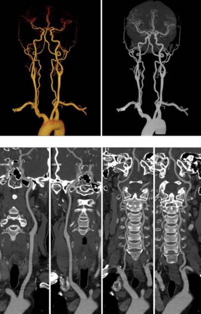 济南南郊医院已成功开展冠状动脉CT强能力，促提升| 冠状动脉
