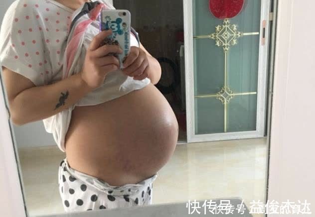准妈妈|晚孕肚子痒,可能暗示这一征兆,准妈妈别疏忽
