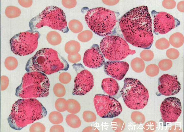 我不是药神|这三类玩具“有毒”,易致儿童患白血病,家长要是买了赶快扔掉