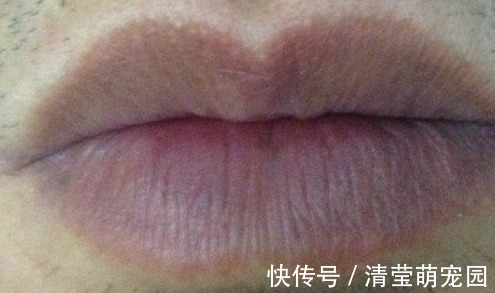 大鱼际|手上有个“救心穴”,长期按一下,心脏血管也就通了