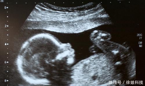 池川明|胎儿有宫内记忆?爸爸:4岁儿子的话让我流泪,早知应更重视胎教