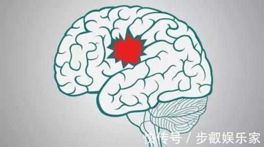 rebecc专家提醒年轻人瑜伽运动不当容易造成中风!