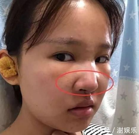 行为|青春期女生“贼伤鼻子”的3行为,难怪没人爱,原来是鼻子在作怪