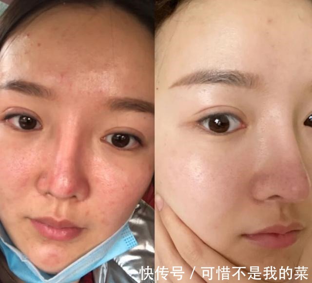 保湿|面霜不一定非要买贵的,3款口碑不错的经典国货,款款好用价不高!