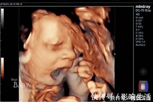 胎动|胎儿性格隔着肚皮能看出来吗?孕期欢脱的胎儿,出生后也多调皮