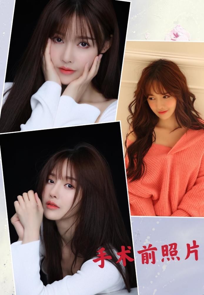 星途|又一女星整容失败,不仅星途尽毁,还面临赔付高额违约金