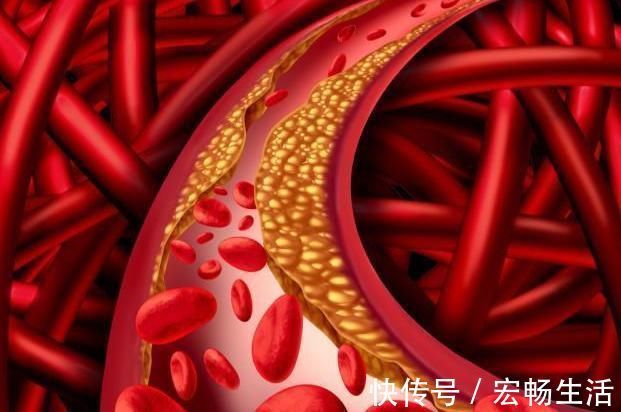 年纪|63岁大爷戒肉一年,血脂飙升,医生:一把年纪,还胡来