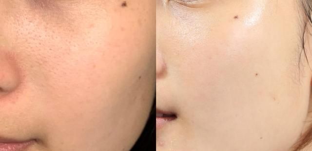 seven|控油成分大盘点,让你这个夏季“清爽干净”,大油皮的福音!