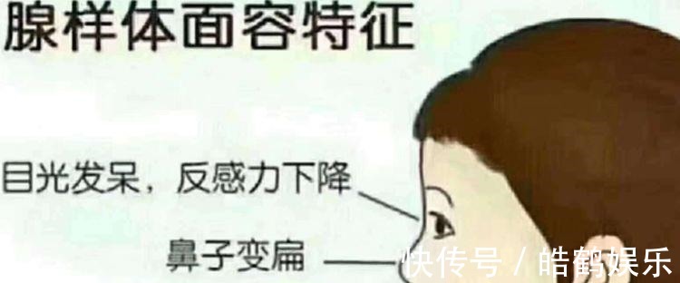 老婆|3岁女儿越长越像猴子,老公怀疑老婆以前整容,查出原因家人凌乱!