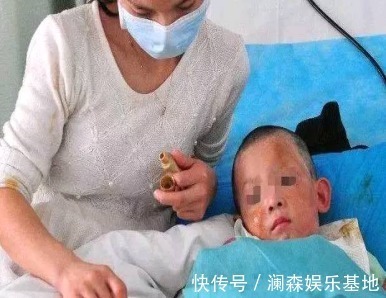 截肢|宝爸宝妈们,这些东西你家都有,它可能会导致宝宝面临截肢!