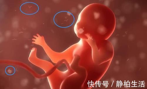 羊水|33岁产妇分娩时突然咳嗽,5分钟后永远闭上了眼,这事孕妈别大意