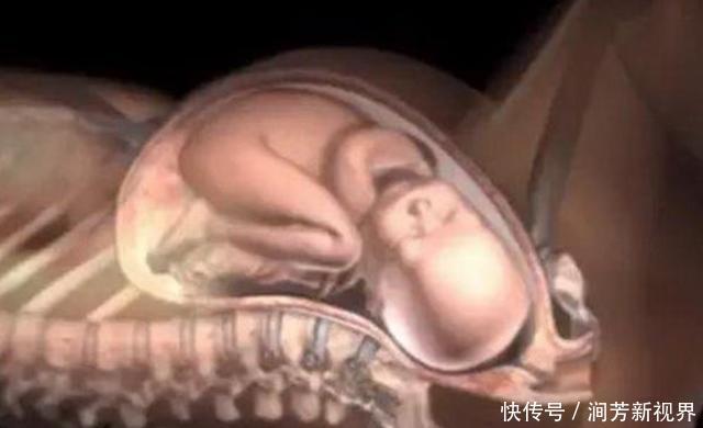 胎儿|顺产分娩时，宝宝咋从产道中爬出来的带你看清全过程，真心不易