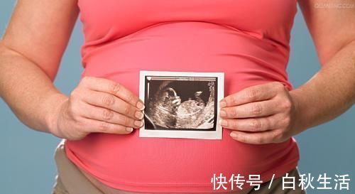 医生|孕妈做排畸检查,医生说太胖看不到孩子的脸,孕妈该咋做呢