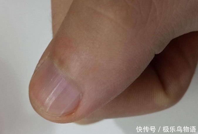 身体|头晕是高血压的第一信号? 若身体有3个变化, 或许血压升高了