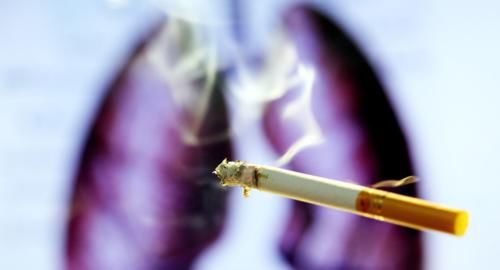 致癌物质|30年来,肺癌发病率增长465%!远离它,你必须了解这3点