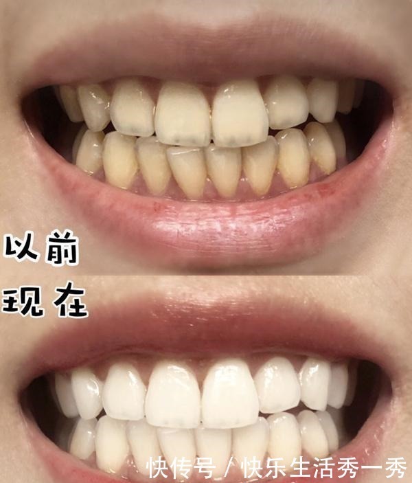 牙膏|李佳琦晒出一款“变态牙膏”，用后黄牙全白了，半个娱乐圈都在用！