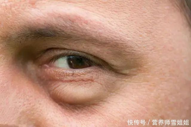 男人，开始衰老，会出现“1臭、2大、3多”，希望你一个也没有