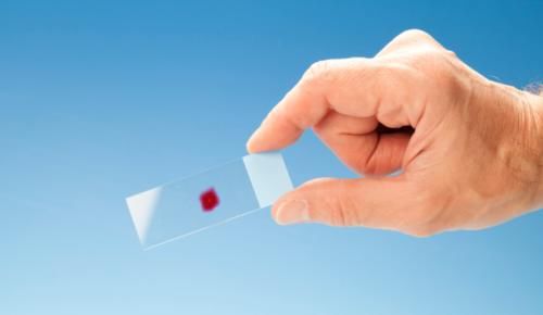 肠癌|息肉是肠癌的种子！协和医生：怎么早发现息肉，得了息肉怎么治？