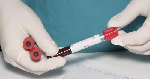 都说“糖尿病患者不能吃4类食物”，到底是哪些食物？一次性告知