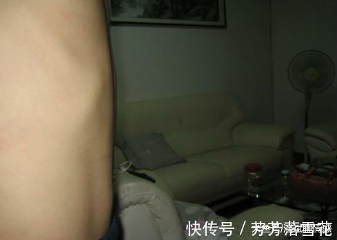 维d|“鸡胸”宝宝越来越多, 到底该怎么做才能预防这种情况的发生