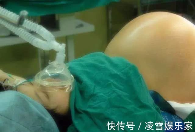 双胞胎|孕妈喜获6胞胎,看到孩子的性别,医生感叹这才是真正的金六福