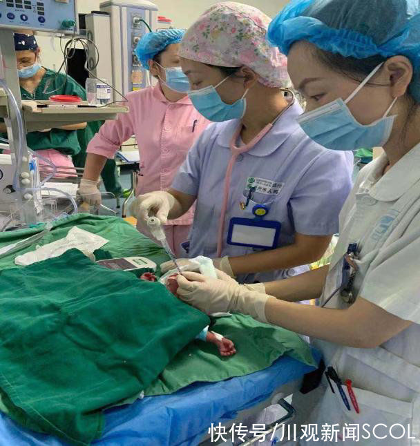 王俊英|体重最低时仅910克！崇州“巴掌宝宝”闯关75天后，如今快5斤啦