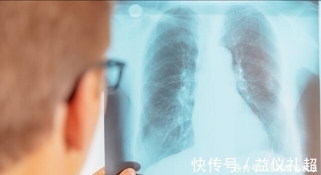 亲人|患癌后该咋办?这些经验和心法值得一看