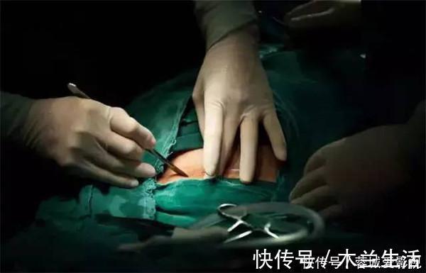 麻药|剖腹产有那么吓人吗剖腹产步骤和注意事项,提前看看做好准备吧